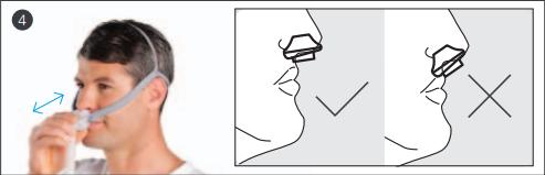 AirFit P10 Anpassung 4 AirFit P10 Anpassung 4