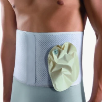 Stoma
