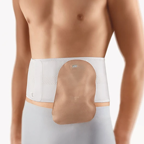 Stoma